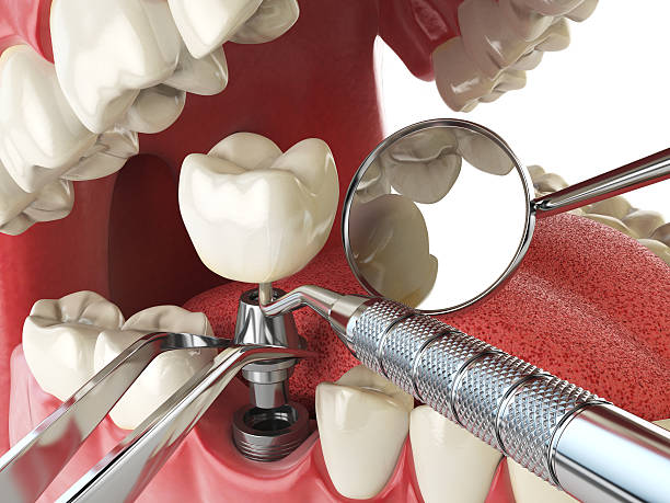 Best Emergency Denture Repair in Kittanning, PA